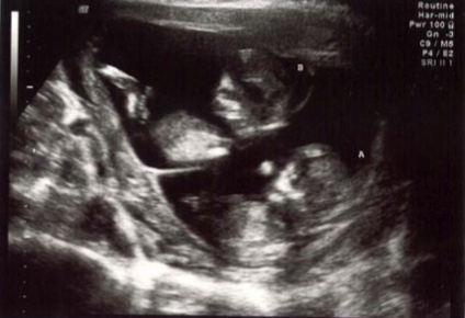 ultrasound2