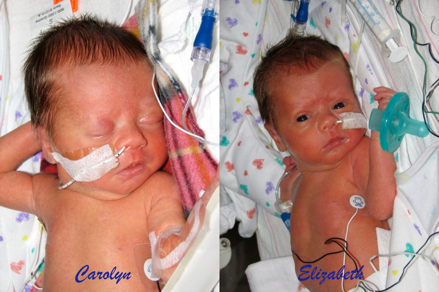 comparison