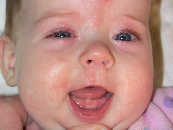 First Tooth